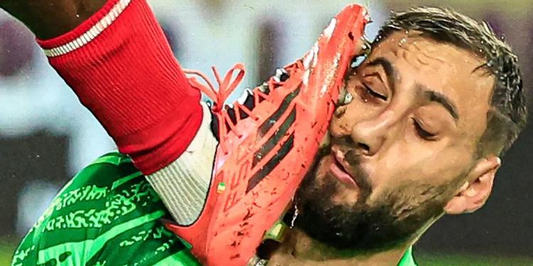 Escalofriante, le metieron una patada en la cara y mira cómo quedó Donnarumma